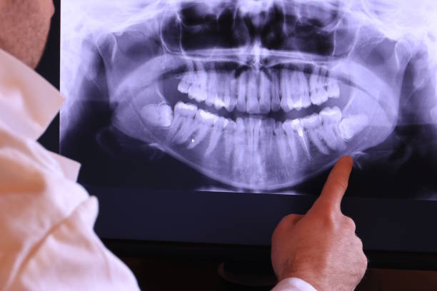 Best Broken or Cracked Tooth Emergency Dentist in Hiawatha, KS