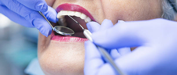 Best Emergency Dentist for Lost Fillings or Crowns in Hiawatha, KS